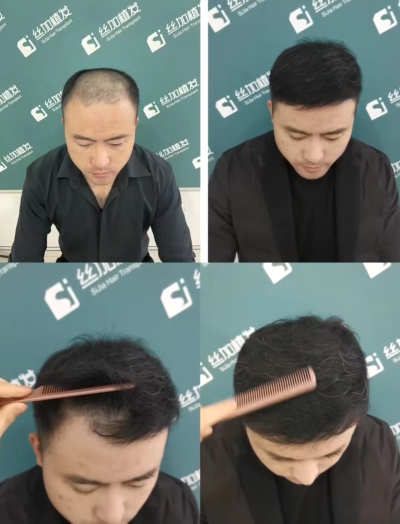 ��ʰ��������׃���󡪡�ֲ�l�g������������